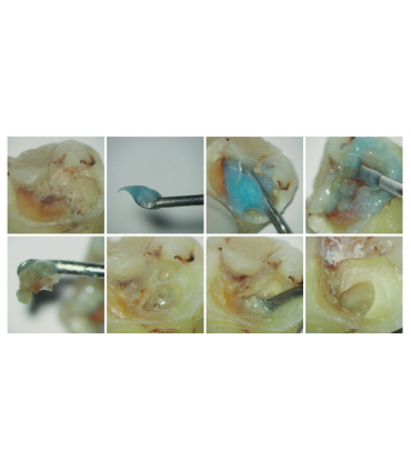 PAPACÁRIE DUO 3ML - OFERTA 2X1